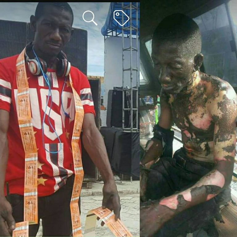 Un employé de l’EDH gravement électrocuté Un employé de l’EDH gravement électrocuté